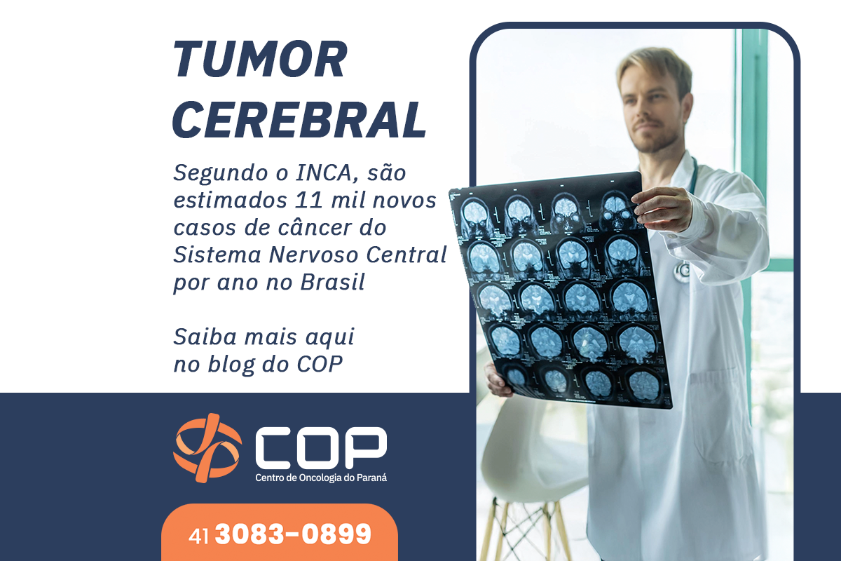 Tumor cerebral: são mais de 11 mil novos casos por ano, por isso, fique atento aos sintomas